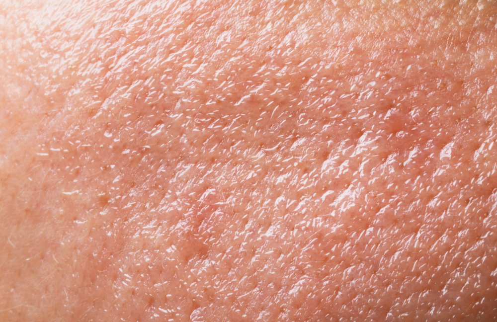 Nahaufnahme von Mischhaut mit sichtbarer T-Zone und leicht glänzender Hautstruktur.